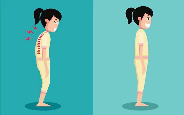 青少年脊柱侧弯免费筛查开始啦！