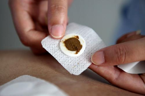 【冬病冬治】市中医医院“三九贴”要来啦！